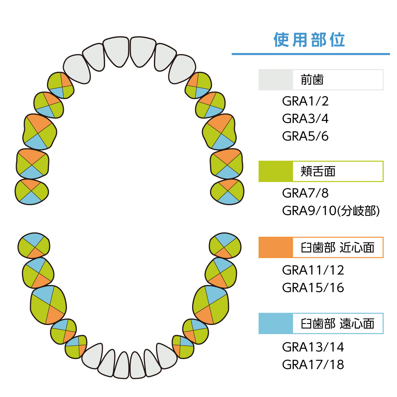 LMグレーシーキュレット