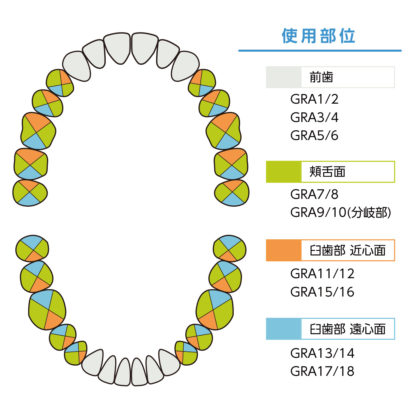 LM グレーシー マクロキュレット AFスタンダード