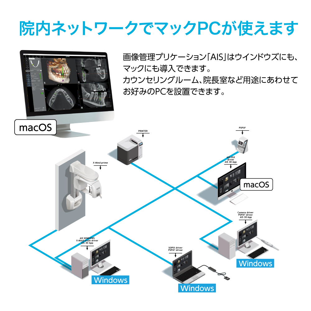 X-マインドPRIME