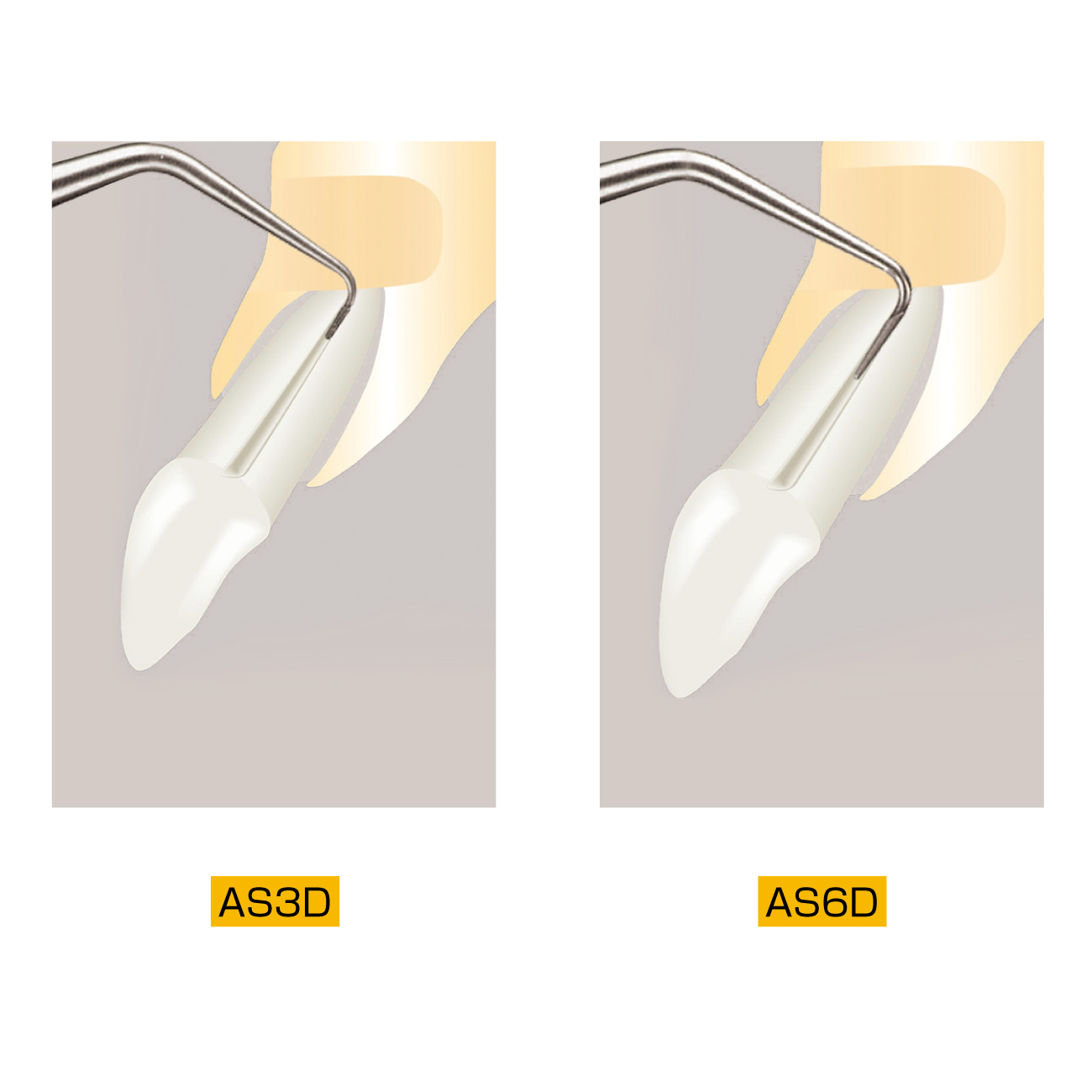 エンドサクセス アピカル サージェリーチップ（逆根充用チップ）