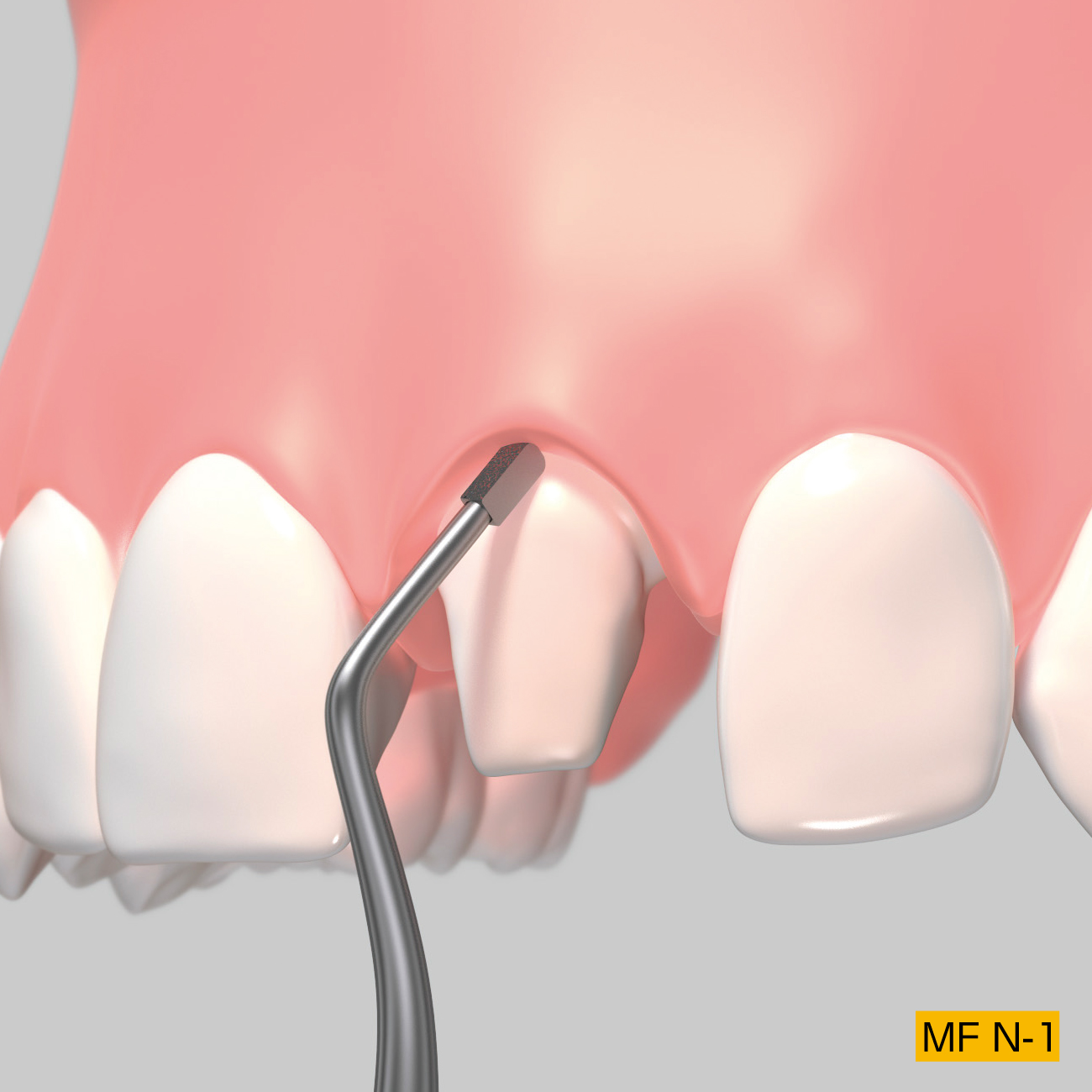 マージンファイル