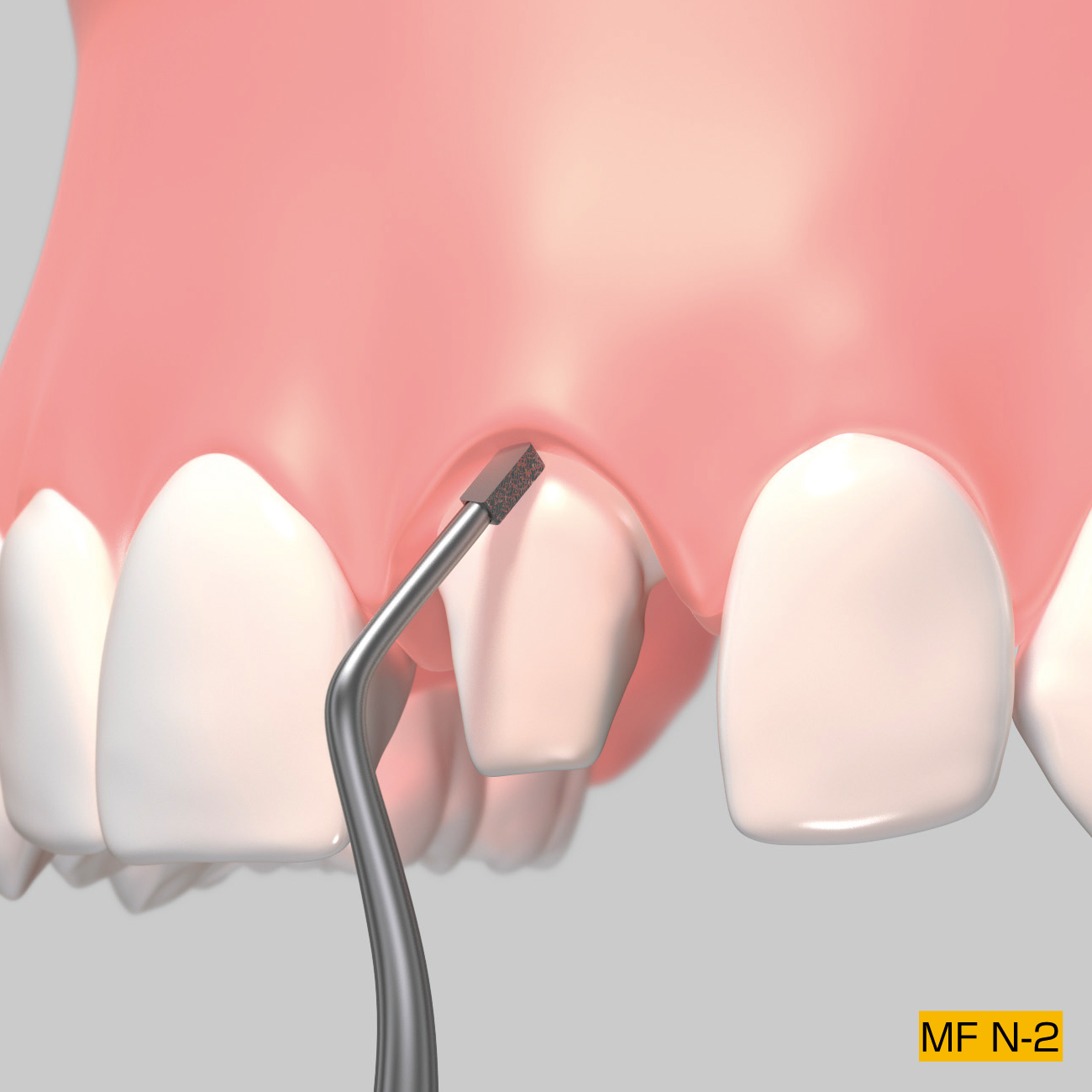 マージンファイル