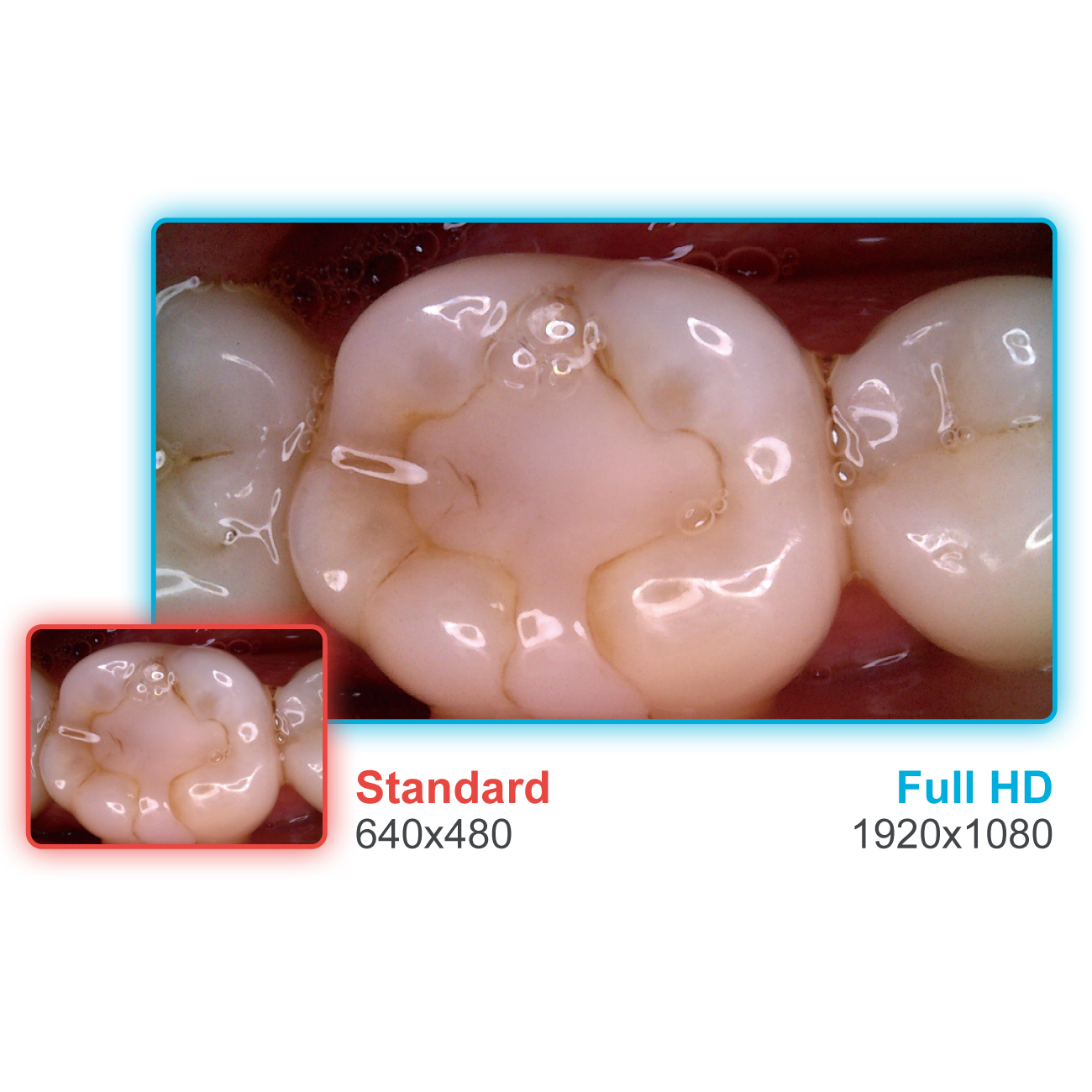 口腔内カメラ ソプロC20