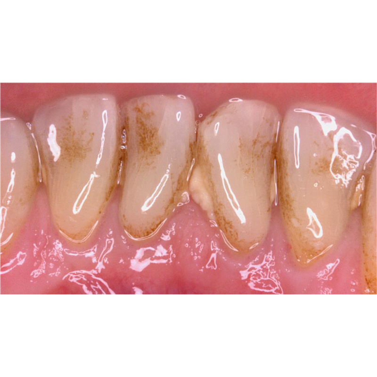 口腔内カメラ ソプロC20